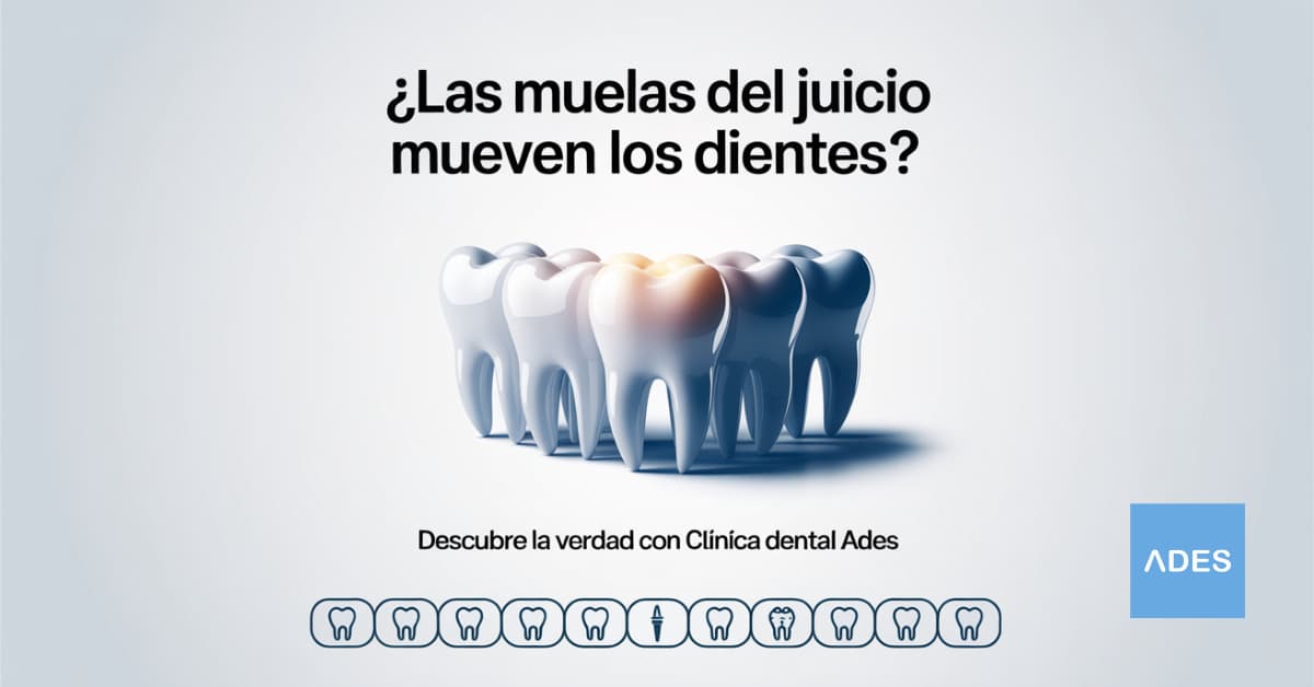 ¿Las muelas del juicio mueven los dientes? Información de Clínica Dental ADES en Badajoz.